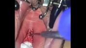 Watch video sex 2021 Teen girl urethra needle play