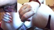 Download video sex new Hardcore anal session with a medical endoscope a super medical fetish video HD