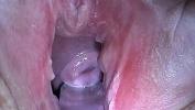 Watch video sex new Cum Injection with Syringe in Cervix Utherus after Fucking online high speed
